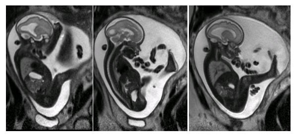 Phụ nữ mang thai có chụp MRI được không?