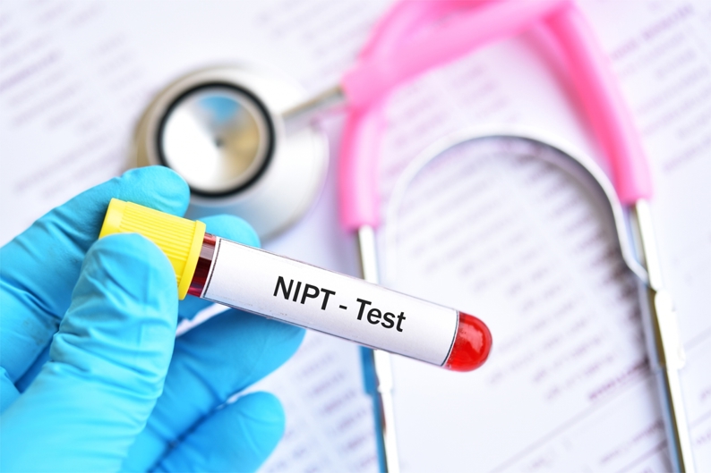 Vì sao mẹ cần sàng lọc NIPT trước sinh từ tuần thứ 10?