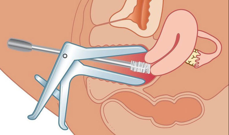 Khám phụ khoa có đau không? Quy trình khám như thế nào?