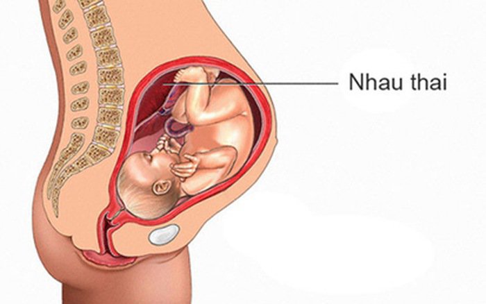 Nhau thai bám thấp có sao không?