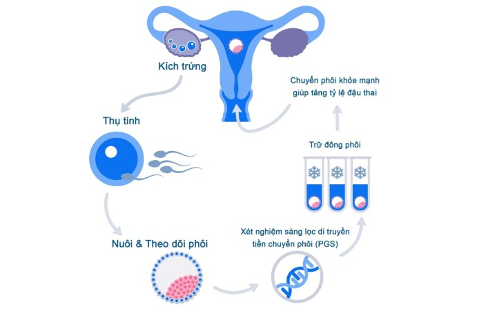 Tầm soát dị tật thai nhi và các phương pháp tầm soát phổ biến