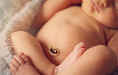 Cách chăm sóc rốn cho trẻ sơ sinh