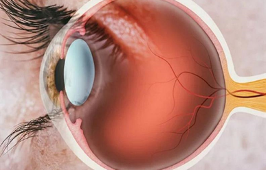 Người bệnh cần chuẩn bị gì trước khi phẫu thuật đục thủy tinh thể?