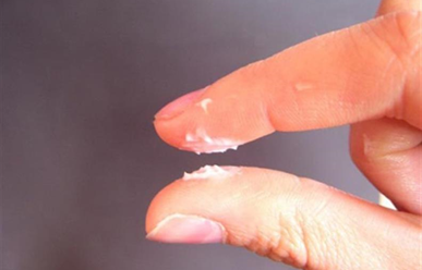 Viêm nấm +++, tái phát nhiều lần