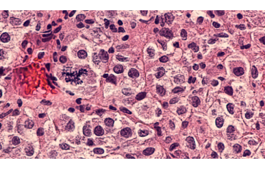 Hy vọng từ vaccine mRNA điều trị ung thư